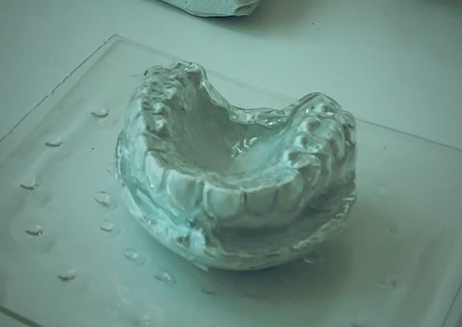 Modelo dental de yeso